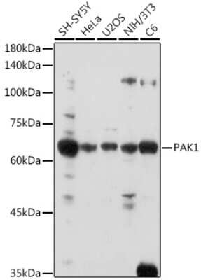 Western Blot: PAK1 Antibody [NBP2-95108] - Western blot analysis of extracts of various cell lines, using PAK1 antibody (NBP2-95108) at 1:1000 dilution. Secondary antibody: HRP Goat Anti-Rabbit IgG (H+L) at 1:10000 dilution. Lysates/proteins: 25ug per lane. Blocking buffer: 3% nonfat dry milk in TBST. Detection: ECL Basic Kit. Exposure time: 180s.